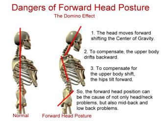 Danger of forward head posture