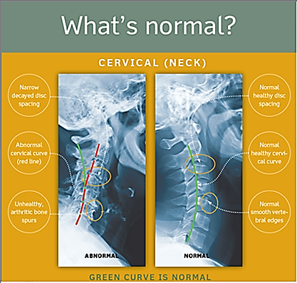 Neck whats normal
